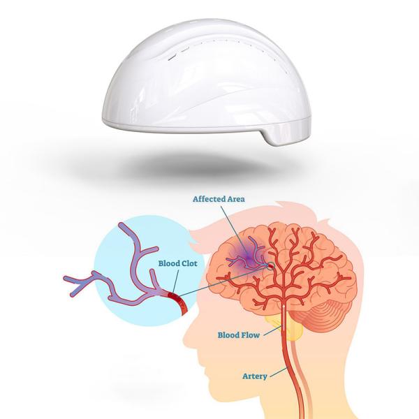 Transcranial Photobiomodulation Photomedicine PBM Machine For Cognitive