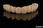 High Aesthetics Layered Zirconia Single Crowns Bridges Implant for Dental