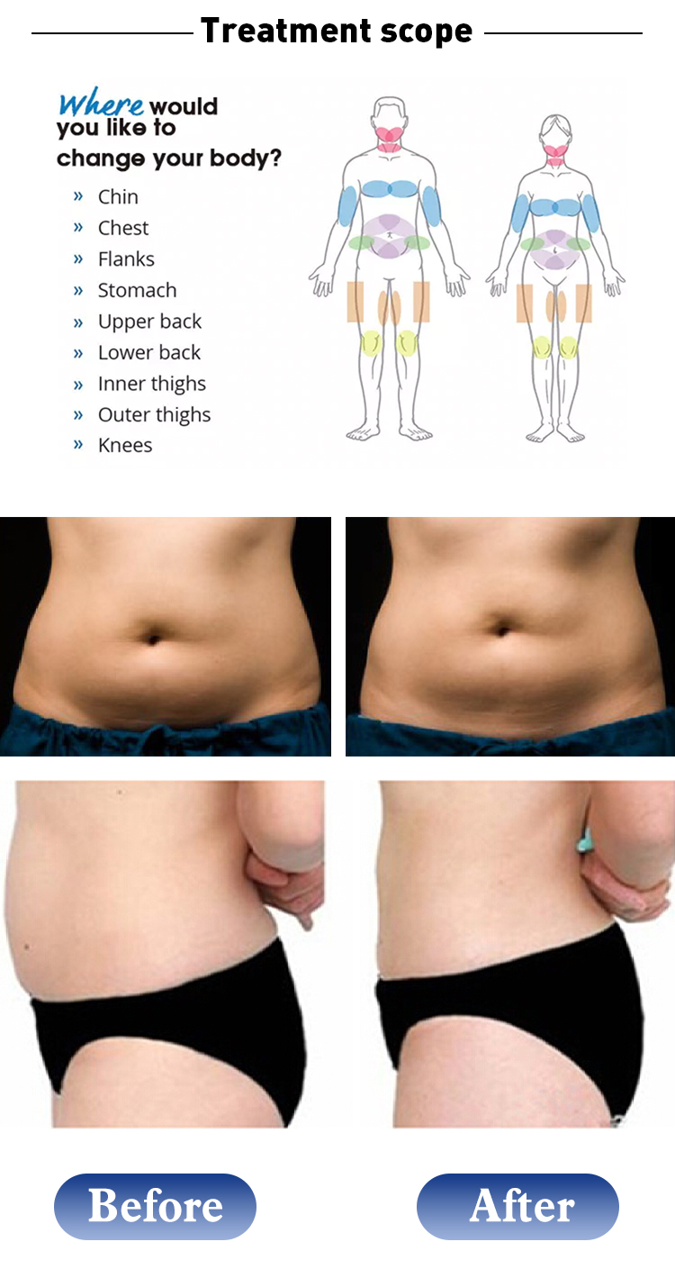 Salon Services with 1060Nm Diodo Laser Body Sculpture Weight Loss Machine