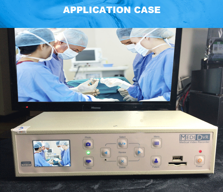 Side Mounted HD Surgical Camera with CE Certification for Exceptional Surgical Imaging