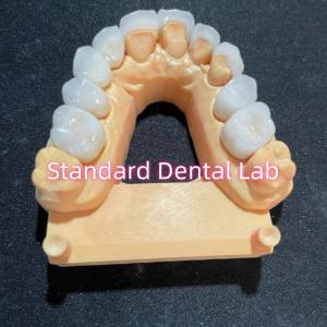 Quality High Esthetic Hollywood Smile Milling Emax Laminate Veneers wholesale