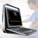 Sonoscape S9 Pregnant Baby Medical Diagnosis 4D Color Doppler Sonography Machine