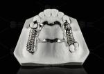 Repairable Cobalt Chromium Dental Metal Framework Partial Denture