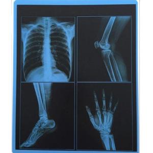 Quality 25cm X 30cm Blue Transparency PET Thermal Film Medical Dry Imaging Film For Hospital wholesale