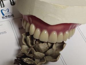 Quality Complete Denture Permanent Esthetics Acrylic Partial Denture wholesale