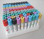 CE ISO Vacutainer With EDTA. K2&Sodium Fluoride/Heparin Sodium&Sodium Fluoride