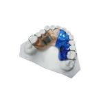 High Durability Adjustable Fixing Orthodontic Appliance Wire