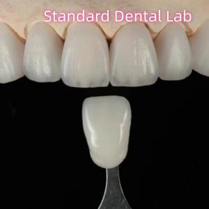 Quality High Aesthetic Natural Customized Aidite Zirconia Dental Bridge wholesale