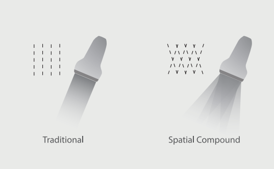New design cardiac and 4d function Sonoscape P15 ultrasound for hospital
