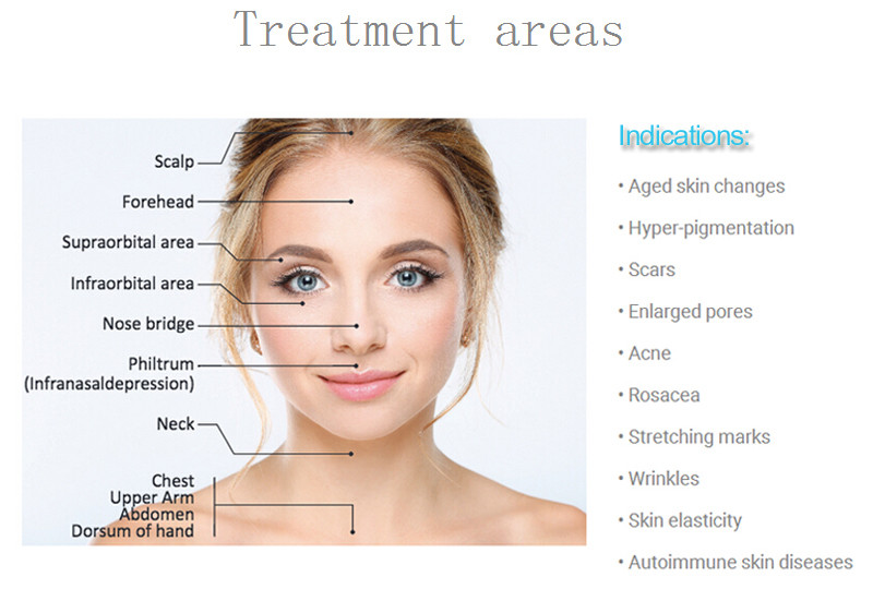 DRS 3 in 1 derma roller for face and body treatment Microneedle Roller 3 Replacement Heads Cosmetic Needling