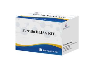 Quality For Laboratory Or Hospital High Accuracy Ferritin Elisa Test Kit wholesale