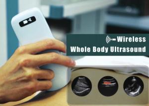 Quality 3.6Mhz Electronic Array Digital Ultrasound Scanner For Abdomen Cardiac wholesale