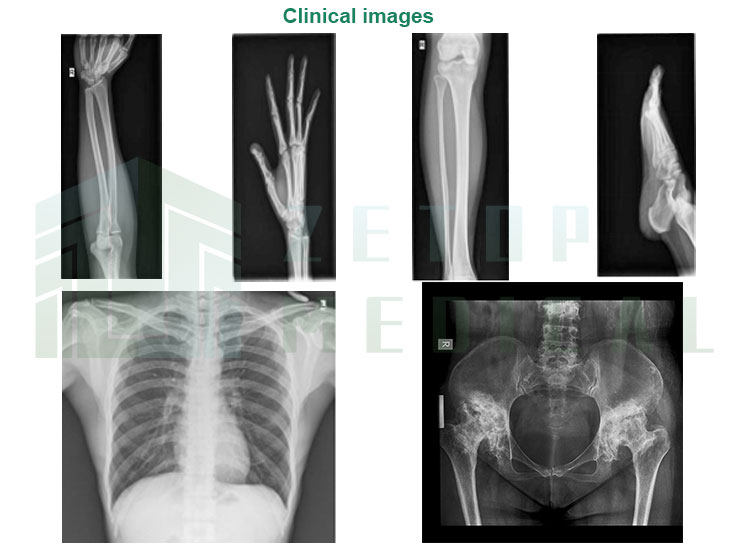 Compact Portable Digital X-Ray Machine with LED Light Source and 10.4inch Touch Screen