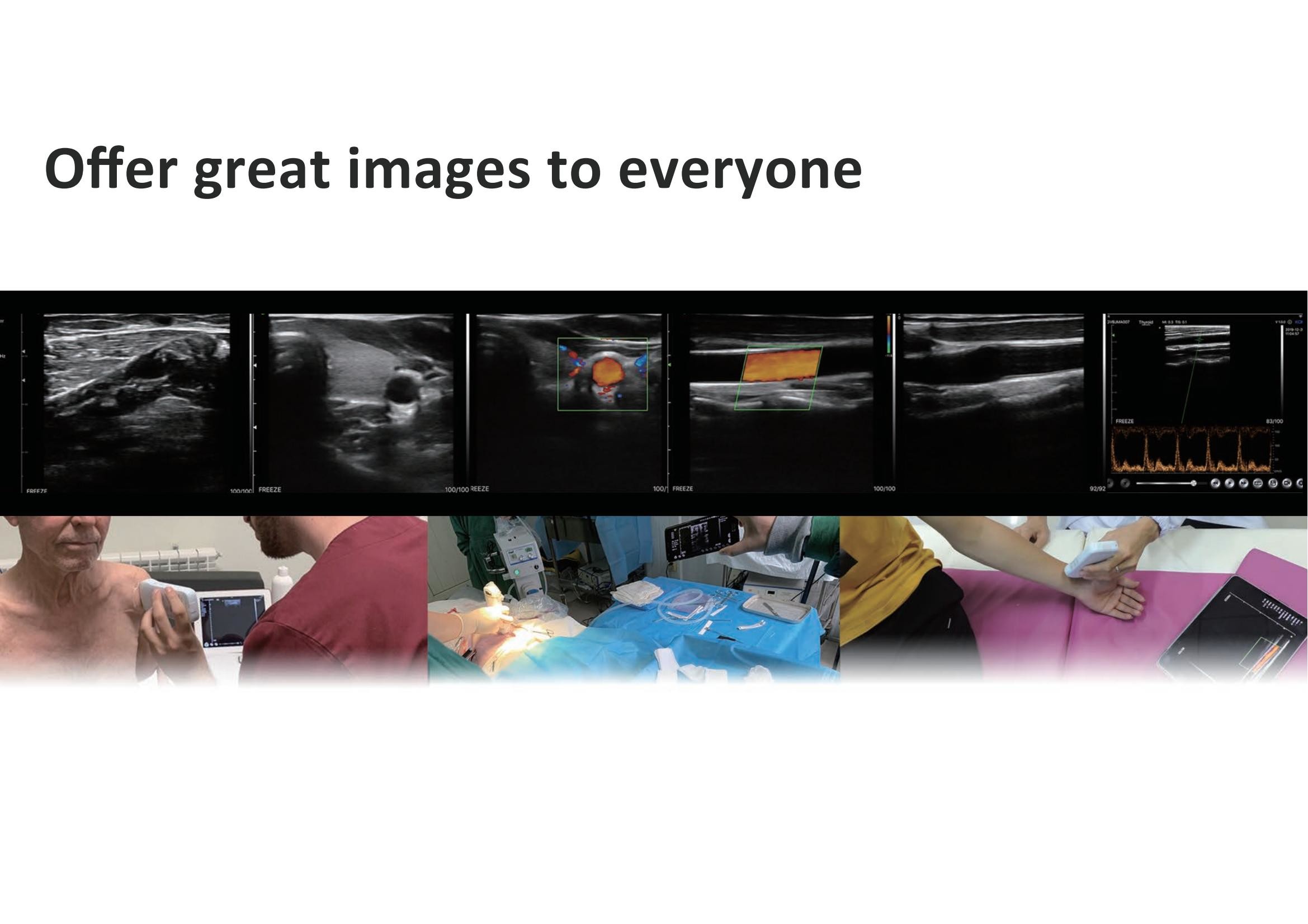 GH 192 Elements Color Doppler Ultrasound Wireless Linear Probe 7.5mhz 10mhz G10CX