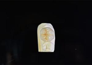 Quality Super Strength Porcelain Dental Crown High Biological Intermiscibility wholesale