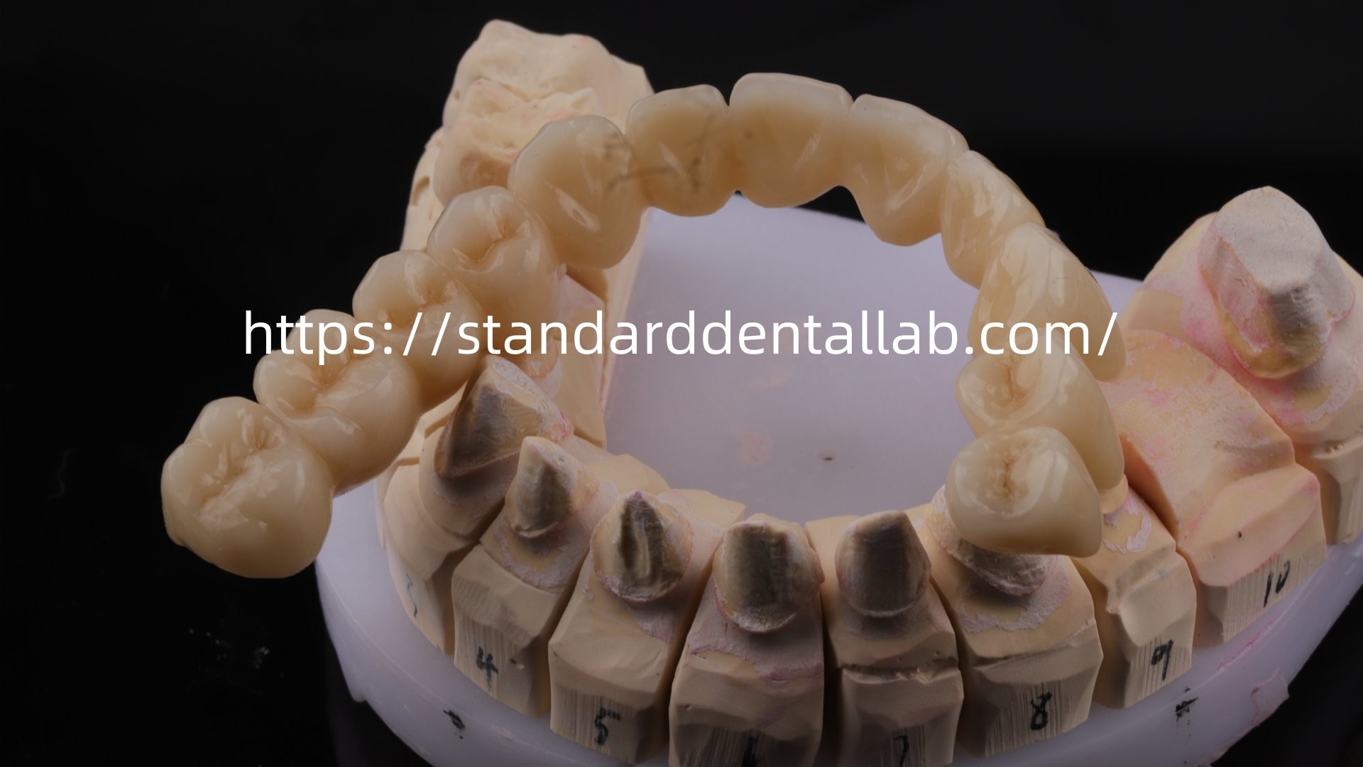 Highly Durable And Natural-Looking Layered Porcelain For Layered Dental Zirconia Crown China Dental Lab