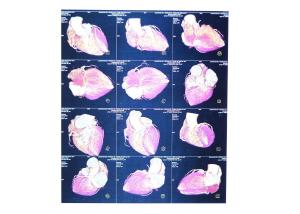 Quality High Sharpness Xray Paper Films , Agfa Dt2b Fuji Medical Thermal Films wholesale