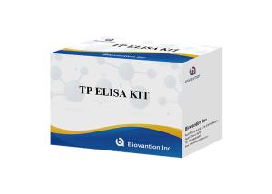 Quality Hospital, Medical Center,Self High AccuracyAnti-TP ELISA Test Kit wholesale