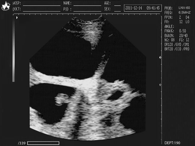 Medical Veterinary Equipment 10.4 Inches Screen Portable Ultrasound Scanner