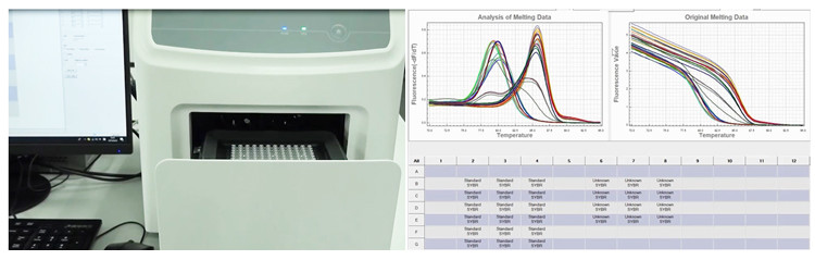 Automatic Real Time PCR Thermal Cycler Machine ODM PC Controlled