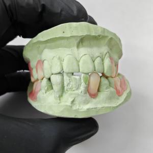 China High Precision Thermoplastic Resin , Flexible Partial Denture Base Resin on sale