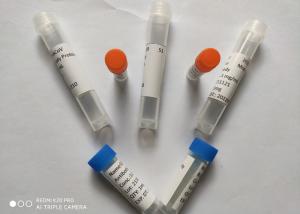 Quality Recombinant Anti COVID 19 Mouse Monoclonal Antibodies Mab Monoclonal Antibody wholesale