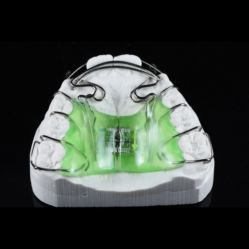 Mouth Orthodontic Expanders Adults Plate For Dental Alignment