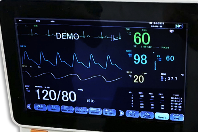 15 inch TFT screen multiparameter medical mobile ambulance patient monitor for hospital