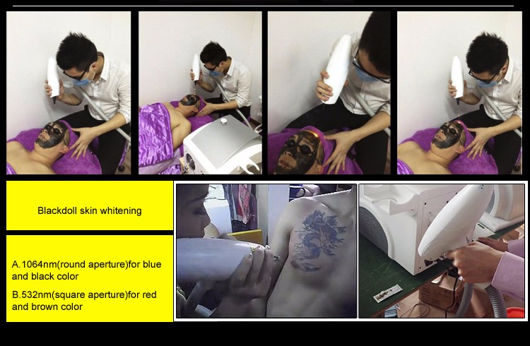 Commercial Multifunctional Beauty Machine 755nm 808nm 1064nm For IPL Opt Laser Hair Removal