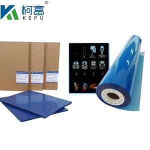 Quality Customized Size 35x43 Inkjet Blue Medical X Ray Film For Epson A4 PET Dry Blue Medical Laser Xray wholesale