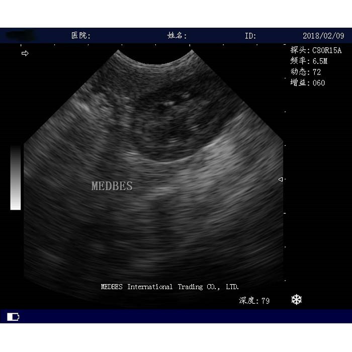 Full digital hospital cheapest 4D trolley color doppler laptop portable