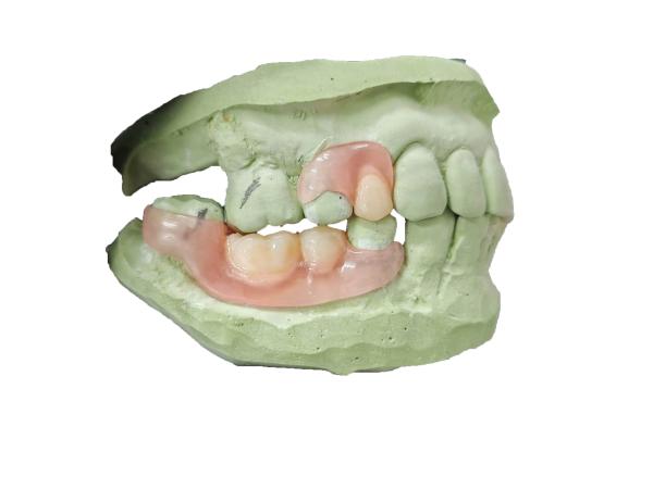 Flexible Denture Base Resin For Partially Edentulous Restoration Stable And