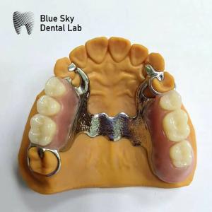 China Dental Cast Partial Denture Framework Partial Dentures That Look Real on sale