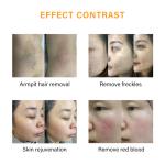 IPL OPT Diode Laser Hair Removal Equipment 480NM SHR Home Use Beauty Machine
