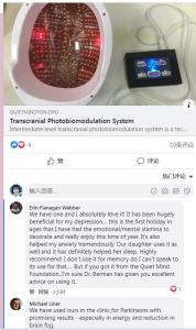 Quality Transcranial Magnetic Stimulation Equipment Treatment Depression RTMS wholesale