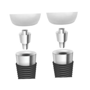 Quality Dental Implant Bars: Revolutionizing Overdenture Stability wholesale