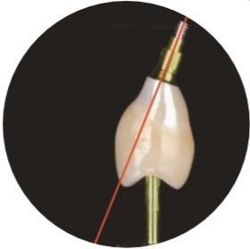 Quality Natural ASC Angled Screw Channel Dental Implants Crown wholesale