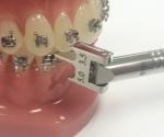 Adjustable Bracket Positioning Gauge Orthodontic Instrument Medical Stainless