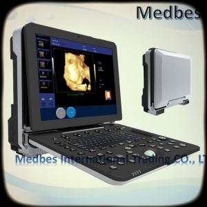Quality 4D Color Doppler Ultrasound Diagnosis System 4D Color Digital Portable Cardiac Ultrasound Scanner wholesale