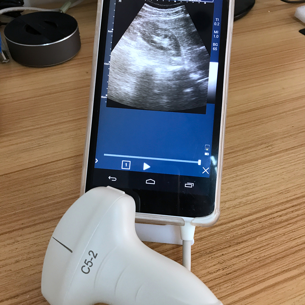 Handheld Ultrasound Scanner convex transducer