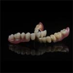Precision Zirconia PFM Crowns Partial Dentures Natural Looking
