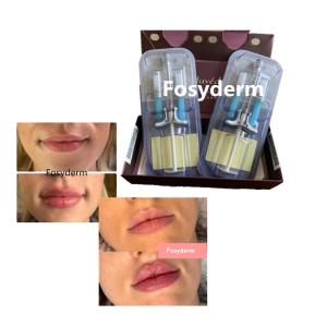 Quality Juvederm Volbella Hyaluronic Acid Lips Filler Cross Linked 24mg wholesale