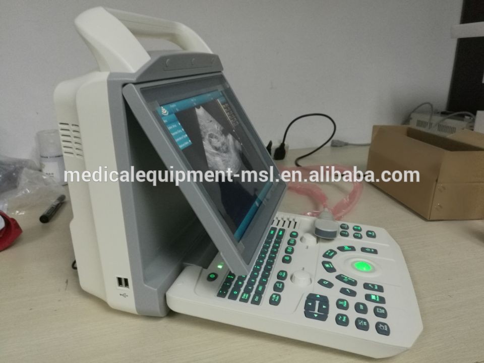 Portable Black & White Ultrasound Machine For Pregnancy Test portable ultrasound machine for pregnancy