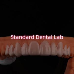 Quality Dental Snap On Smile Veneers For Teeth Discolorations / Gaps wholesale