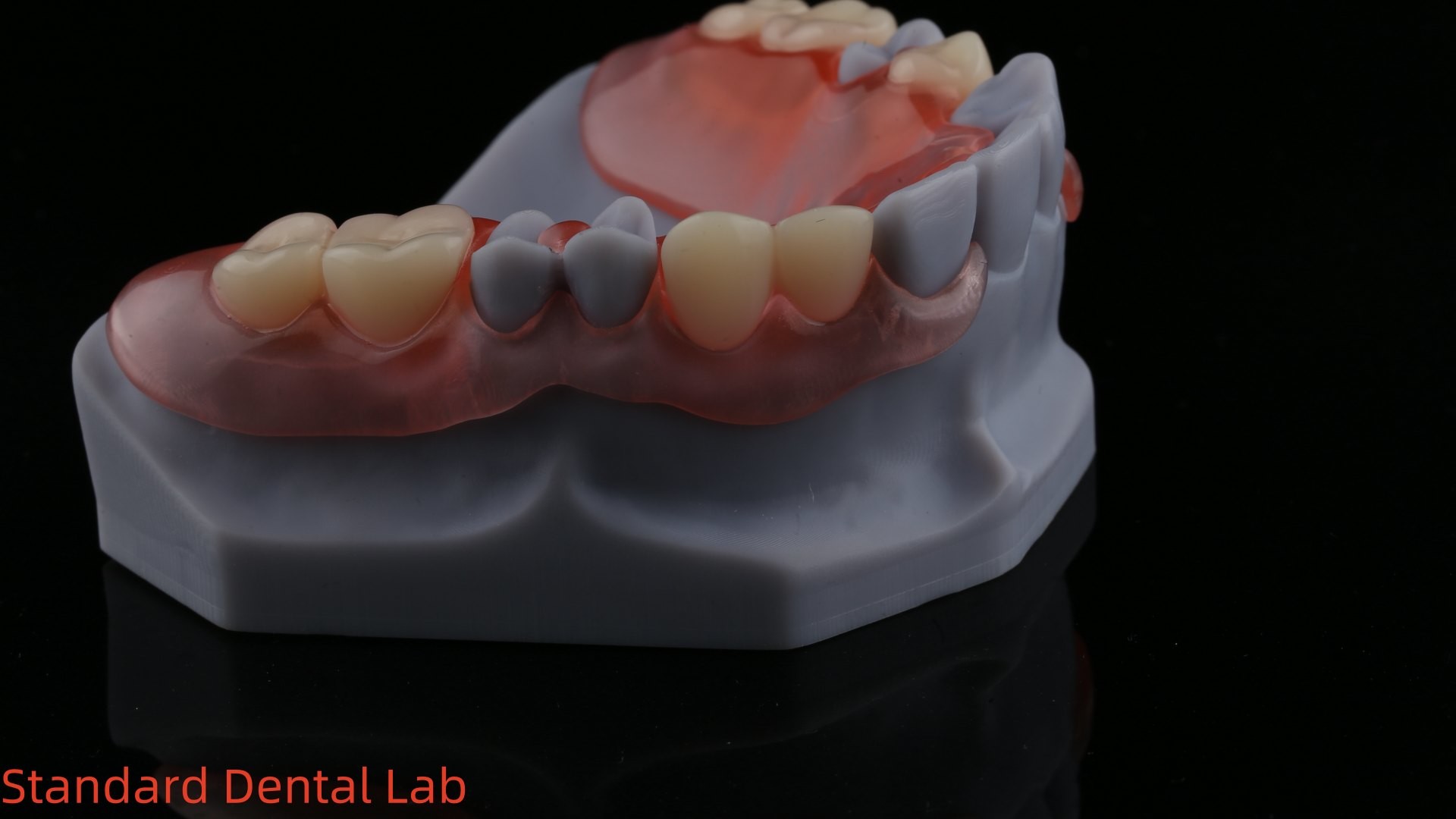 3D Print Model High Esthetics Dental TCS Valplast Flexible Partial Dentures Dental Lab