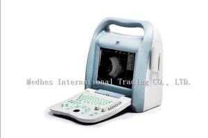 Quality High Accuracy Portable Ophthalmic A B Scan Ultrasound Machine wholesale