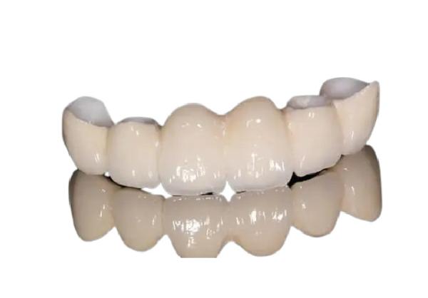 Corrosion Resistant Porcelain Dental Crown Natural Appearance For Front Teeth /