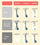 755nm 808nm Skin Rejuvenation Machine , 1064nm Diamond Microdermabrasion Machine