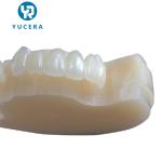 Dental Multilayer Zirconia Disc Acrylic 95 PMMA Block For Temporary Teeth