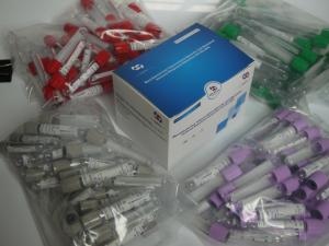 Quality Tuberculosis-Interferon Gamma Release Assay Elisa kit Manufactured by Biovantion wholesale